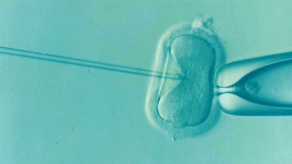 IVF - טיפולי פוריות בהן מתבצעת שאיבת ביצית