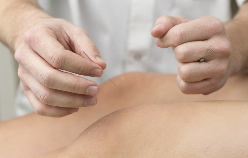 תום דיקור סיני בחיפה מעודכן