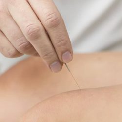 תום רוטנברג - דיקור סיני לכאב ברכיים